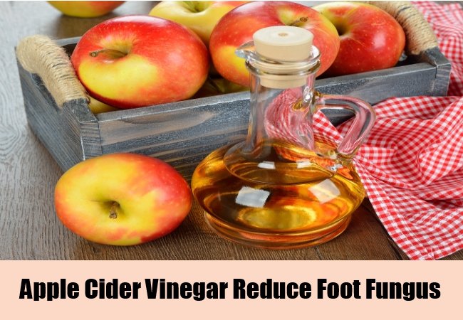 Vinegar Is Effective To Kill Fungus Listerine Foot Soak