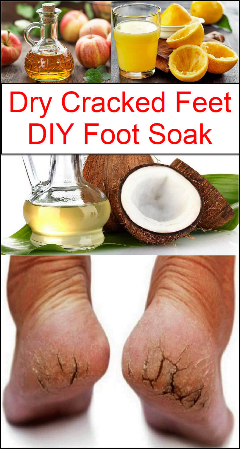 dry feet soak