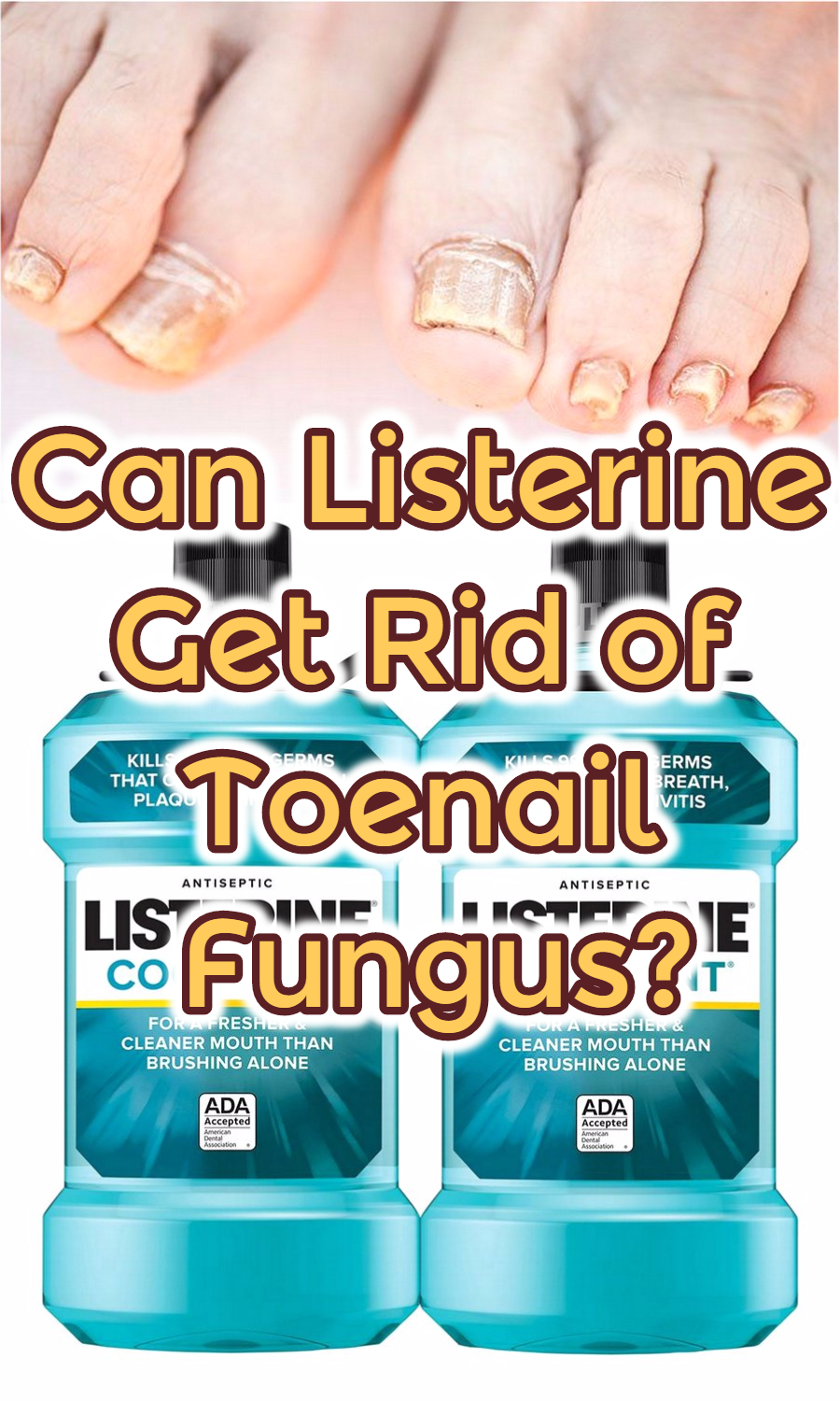 can-listerine-get-rid-of-toenail-fungus-listerine-foot-soak