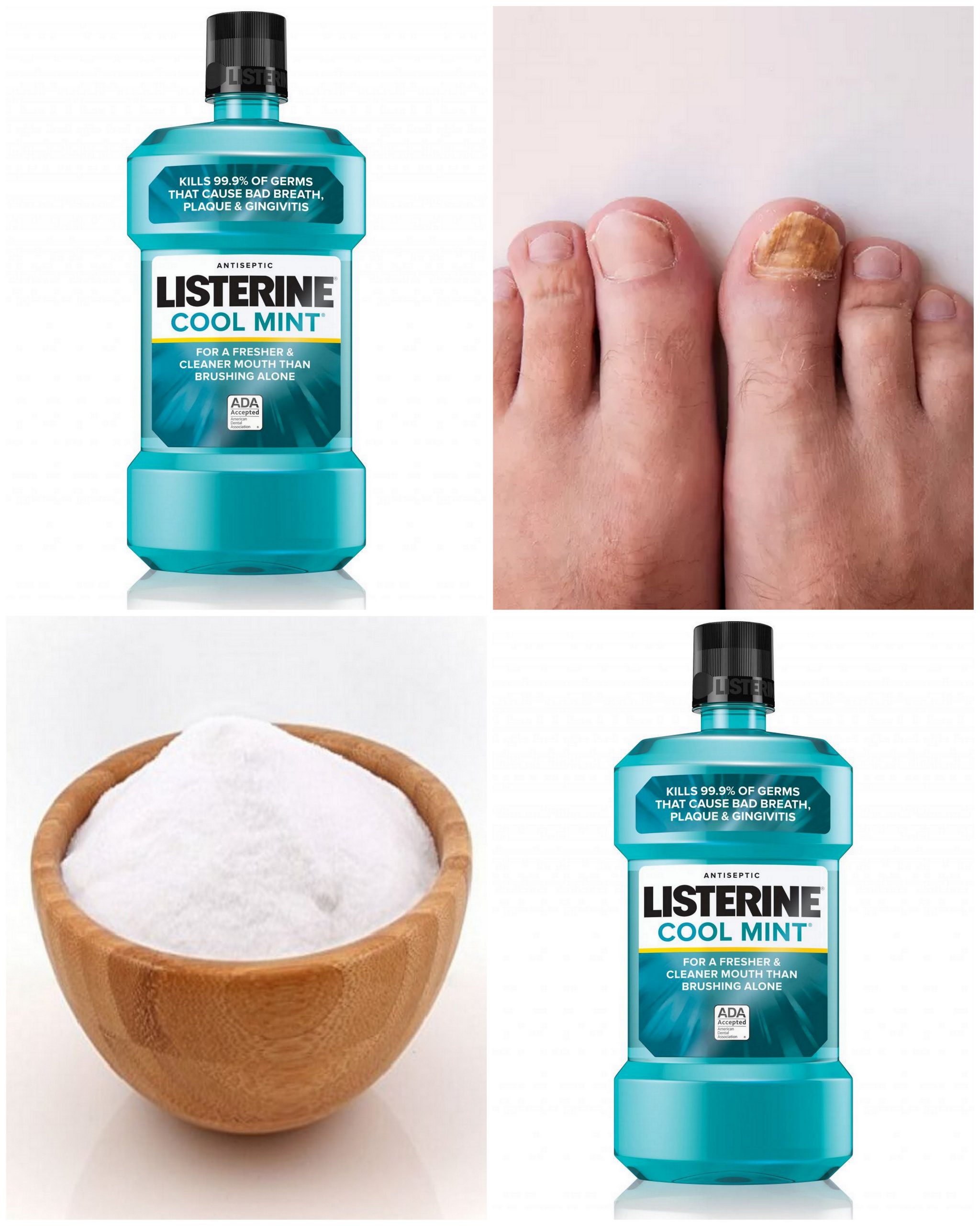 Home Remedies For Toenail Fungus With Listerine Listerine Foot Soak